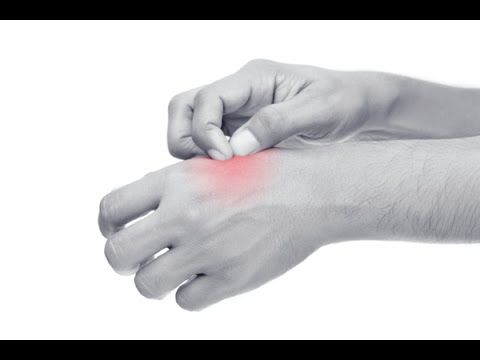 Episode 1 - Understanding Eczema and How to Handle it Naturally