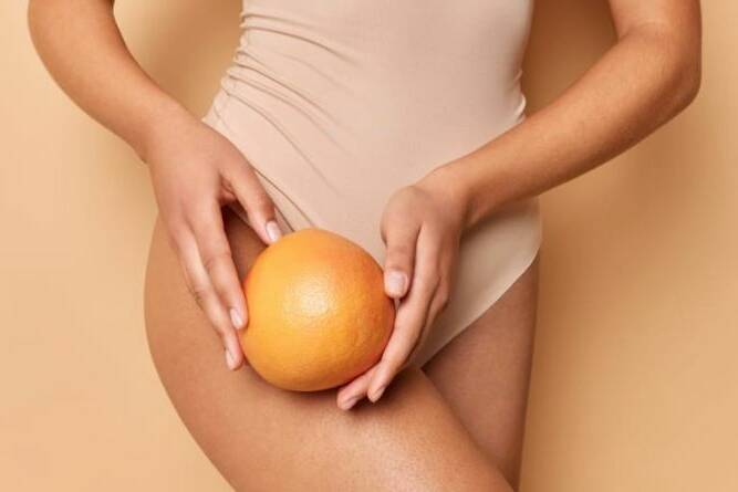 Conscious About Cellulite? Learn About Its Causes, Lifestyle Changes and DIY Remedies