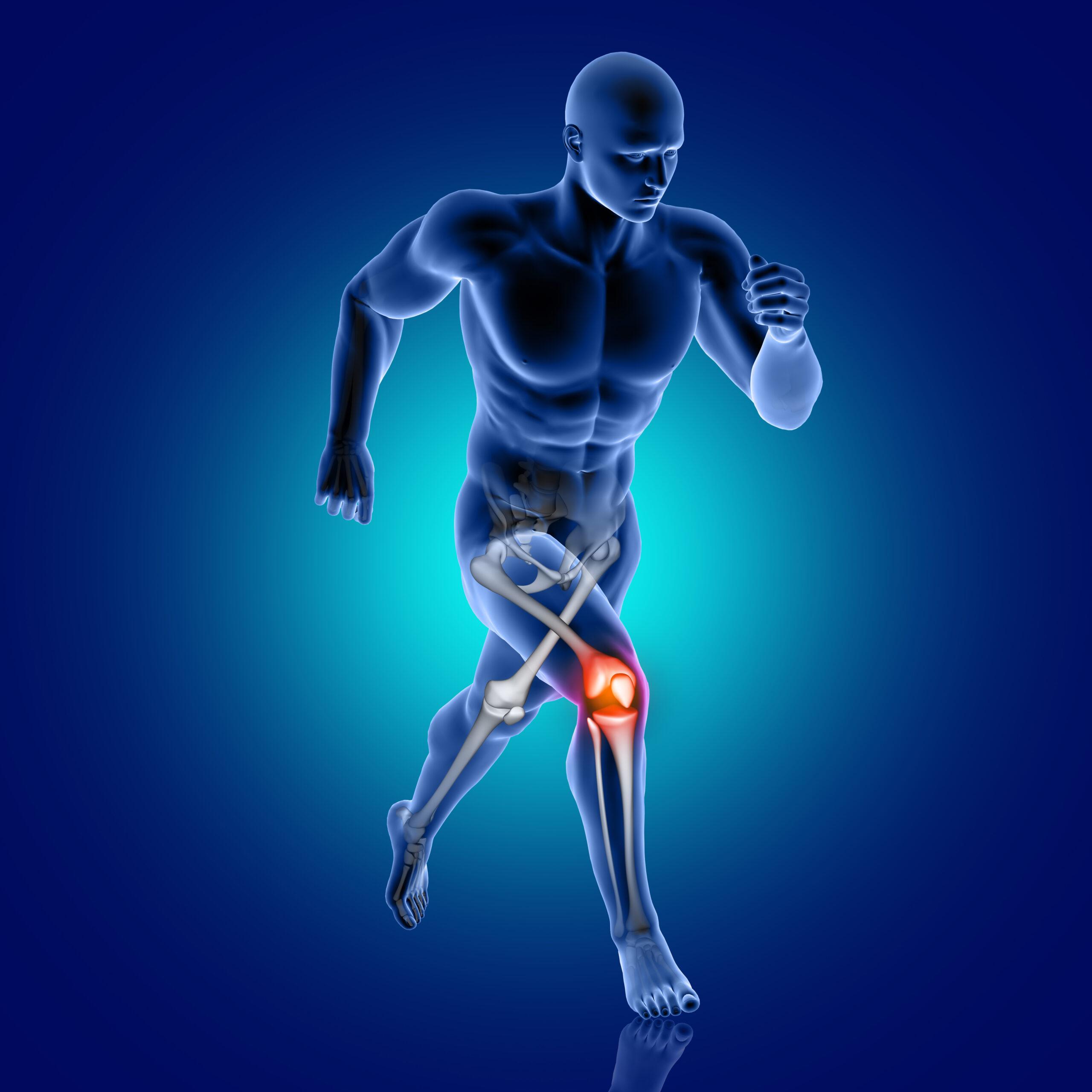 Need Stronger Bones Without the Gym Try These Inexpensive Exercises Today