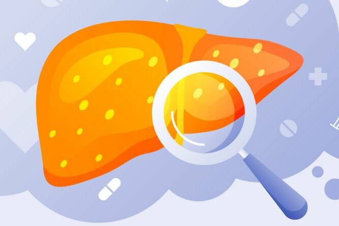 How To Reverse Fatty Liver 13 Top Lifestyle Changes To Make Today