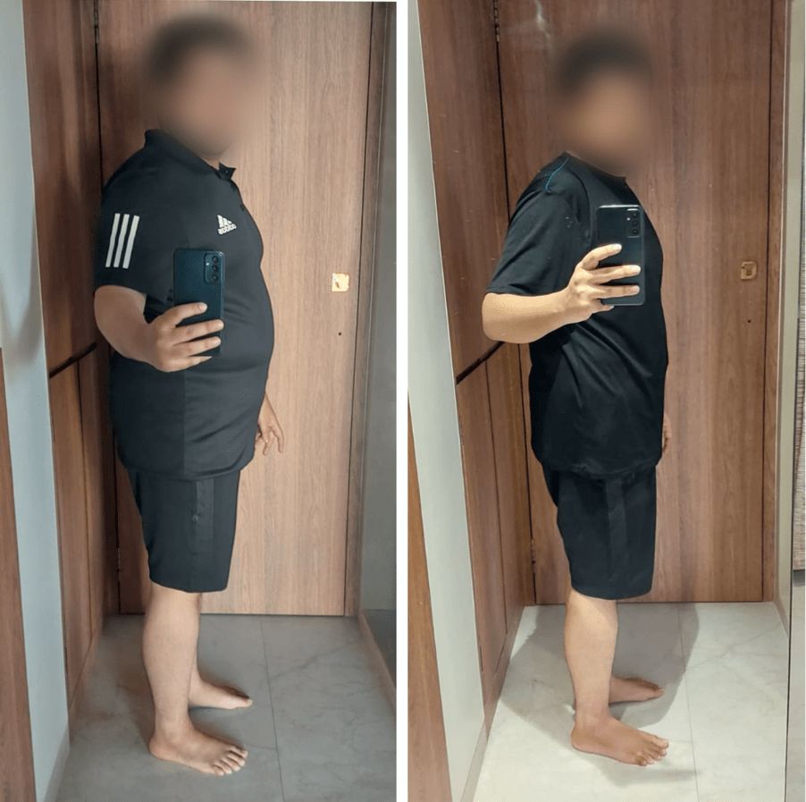 From 103 Kgs to 86.7 Kgs in Just 90 Days: Rahul’s Ultimate Fat Loss Triumph