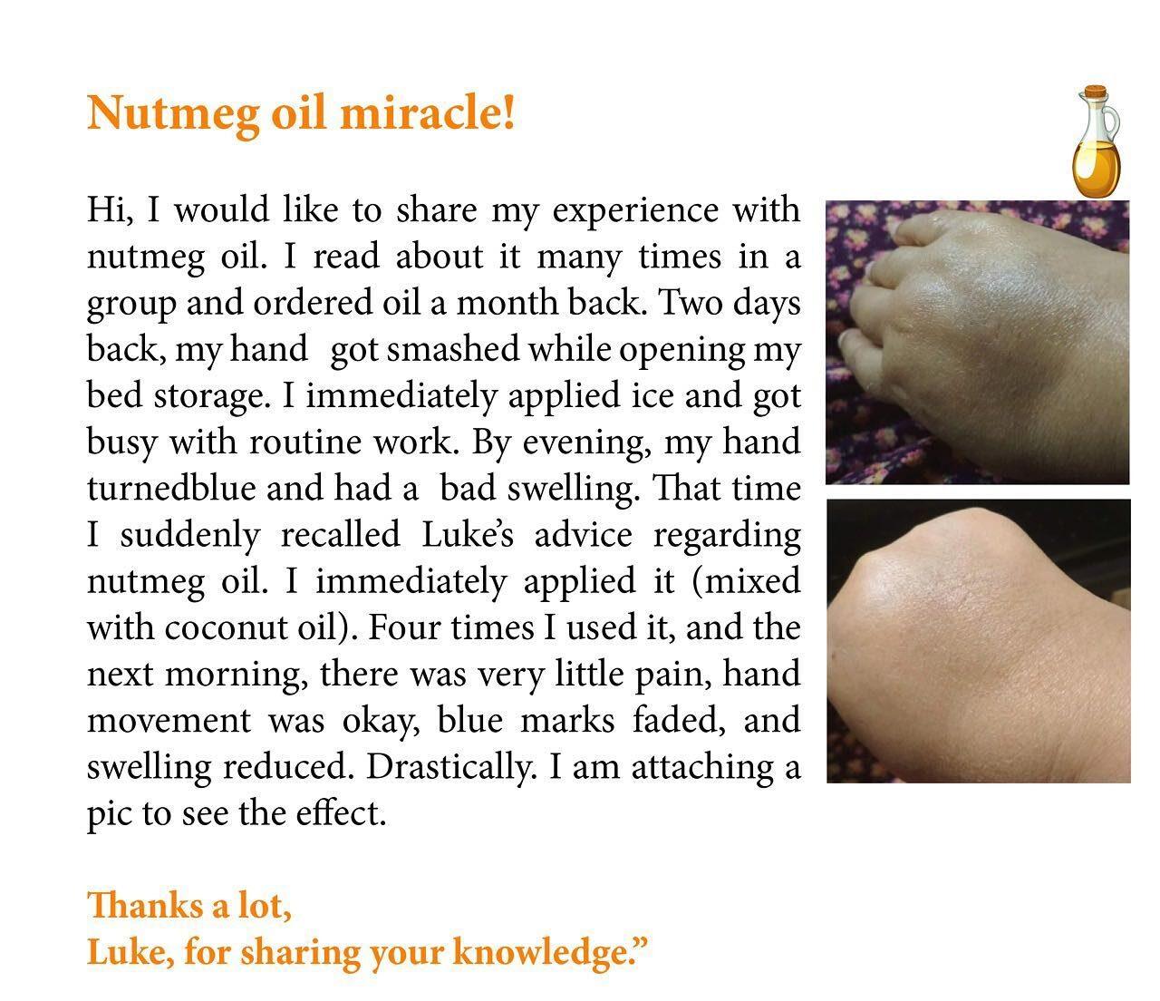 joint-pain-remedy-nutmeg-oil
