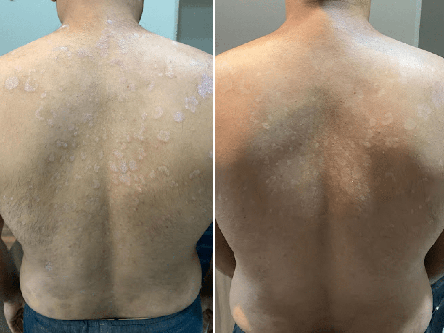 Skin-care-Story-111-min