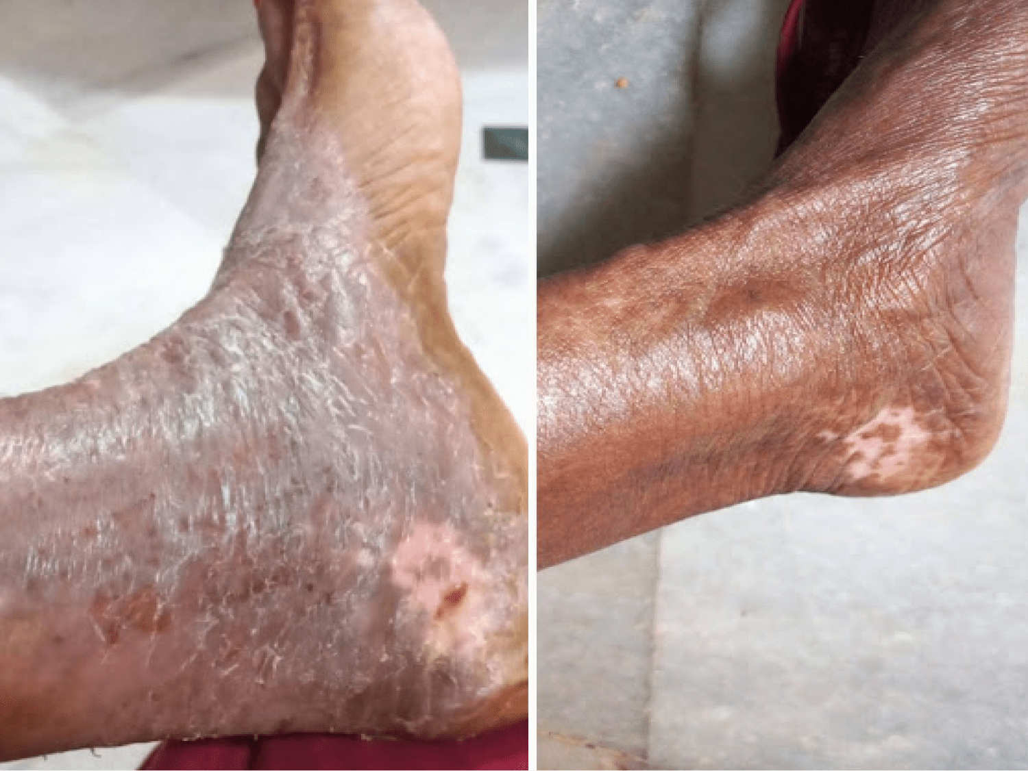 Skin-care-Story-12-min