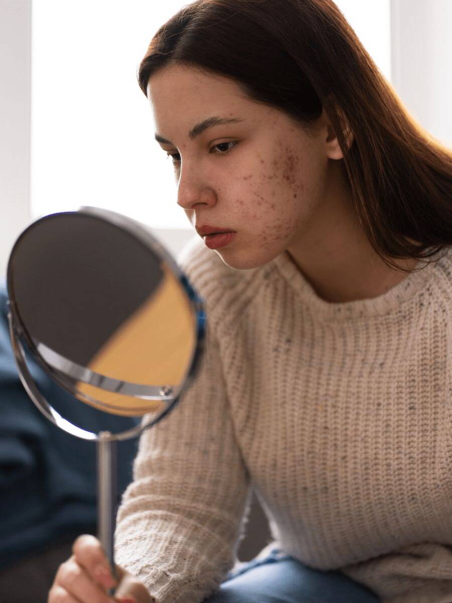 Skin Care Program