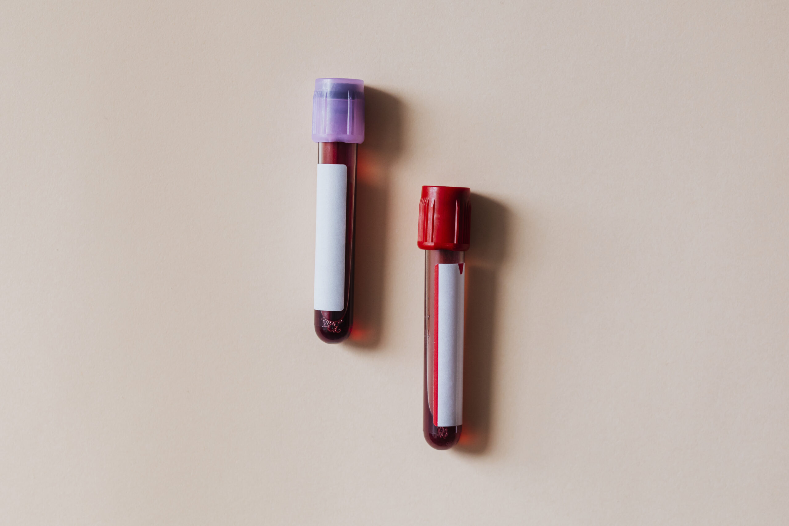 Think Your Cholesterol is Fine? There’s One Test You Might Be Missing