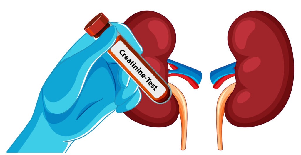 kidney care