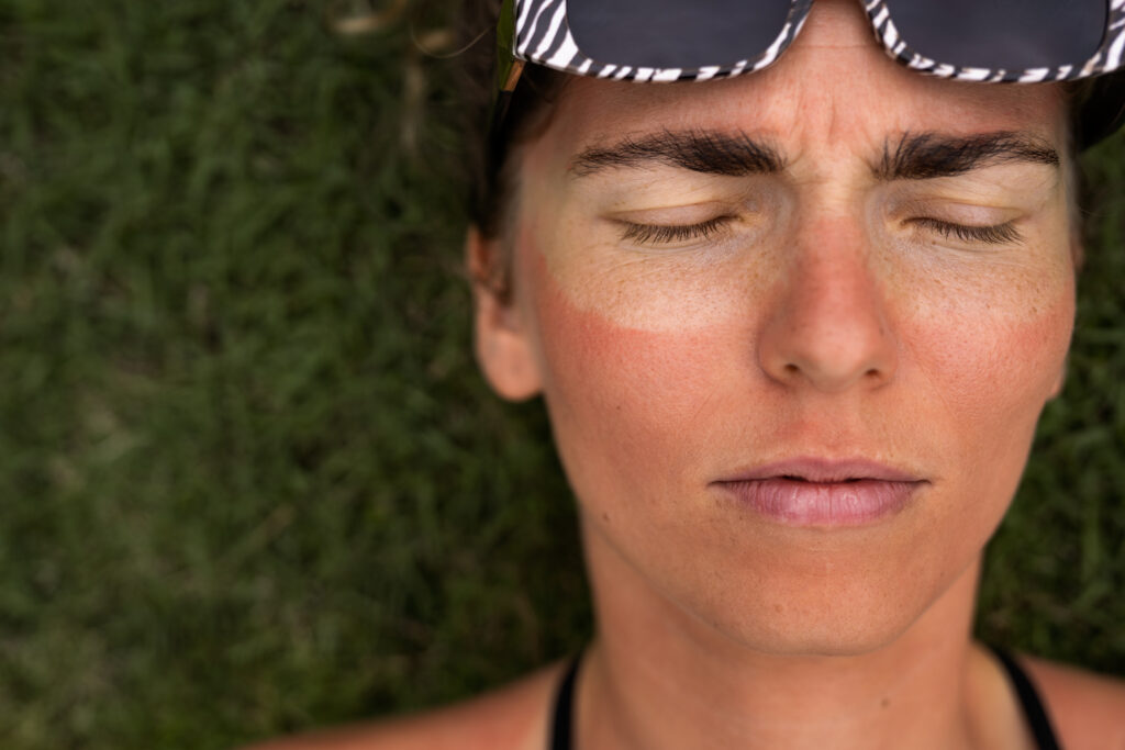 skin problems white spots