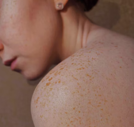 04 Skincare Conditions